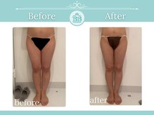 美人バスト 犬山店/【下半身ダイエット】症例♪