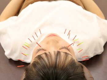 竹ノ塚喜楽鍼灸接骨院の写真/今大人気の美容鍼で憧れの小顔へ近づこう!カウンセリング込みで、お得に美しさを手に入れよう☆