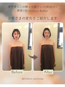 エステティックシトラス(esthetic CITRUS)/before & after