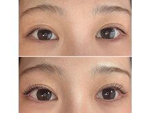 プローサム(Prorsum)の雰囲気（施術時間は約30分！寝ているのが苦手な方もご安心ください♪）