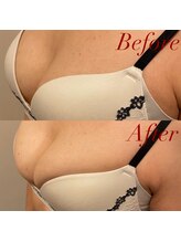 IBC 横浜馬車道店/★Before-After