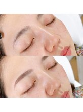 ホワイトアイ 京橋(WHITE EYE)/京橋/眉毛/アイブロウ