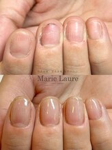 マリーロール 淀屋橋本店(Marie Laure)/自爪育成/深爪矯正/ネイルケア