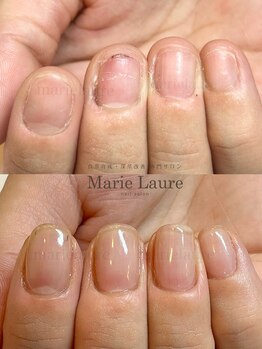 マリーロール 淀屋橋本店(Marie Laure)/自爪育成/深爪矯正/ネイルケア