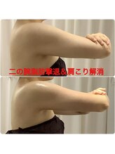 ちゅるん肌ドットコム 心斎橋店(ちゅるん肌.com)/二の腕＆背中集中１回