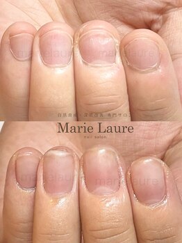 マリーロール 淀屋橋本店(Marie Laure)/自爪育成/深爪矯正/ネイルケア