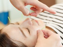 西船はりきゅう接骨院の雰囲気（自律神経/美容鍼/体調管理/女性特有のお悩みもご相談ください♪）