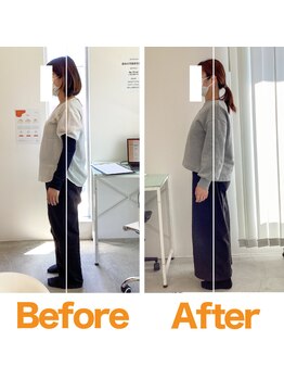 整体院ひなた 宮崎院/産後骨盤-8cm!!肩こりも改善宮崎