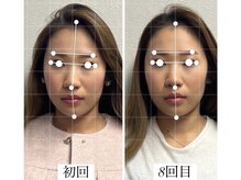 ラボーテヴェリテ(La Beaute Verite)の雰囲気（美容　整形でも難しい複雑な歪みや左右差、面長のお悩みも改善◎）