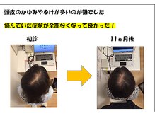 かがわ接骨院 高松伏石院/頭皮トラブルお任せください！