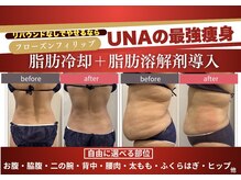 ウナ シロカネ(UNA SHIROKANE)