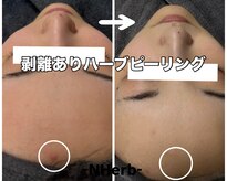 エヌハーブ(NHerb)