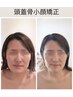 技術力の高さが人気◎《解剖学に基づく本格技術♪☆》頭蓋骨小顔矯正