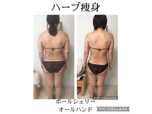 ビューティーチャージ(BeautyCharge)