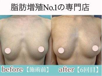 サラエクセレント 銀座/数回でもサイズUP！バストケア