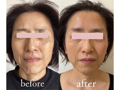 トリートメントルーム フェリーチェ(Felice)の写真