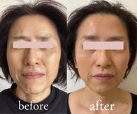 トリートメントルーム フェリーチェ(Felice)