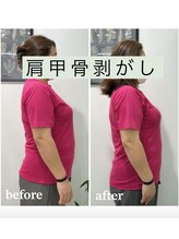ギャラクシービューティー(galaxy beauty)/肩甲骨はがし