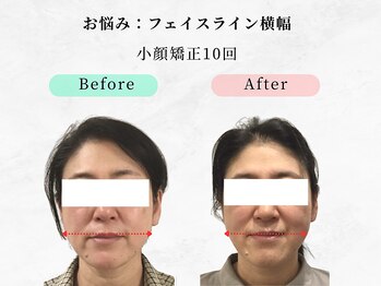 美容整体ウェリナ 中川八田院/小顔矯正/骨盤矯正/痩身整体