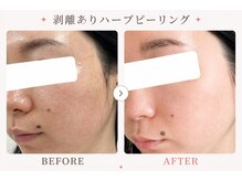 パールプラス 那須塩原黒磯店(Pearl plus)/複数回重ねる度に艶肌陶器肌へ