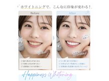 ハピネス 心斎橋アメリカ村本店(Happiness)/疲れやすい、毛穴くすみ気になる