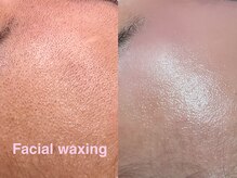 レネットサロン(Reinette Salon)