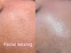 レネットサロン(Reinette Salon)の写真