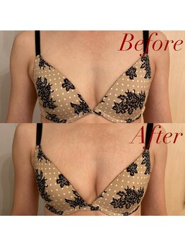 IBC 横浜馬車道店/BeafteafteAfter