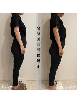 アール アンド ビューティーサロン(Ｒ＆ BeautySalon)/産後のぽっこりお腹も改善！