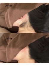 アルティ 福岡大名店(ARTI,)/襟足美人