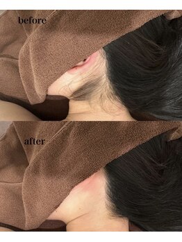 アルティ 福岡大名店(ARTI,)/襟足美人