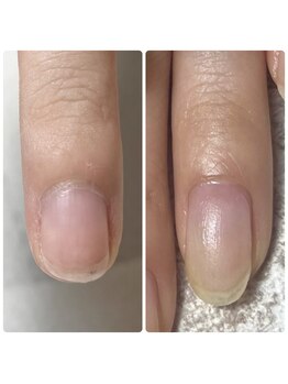 サエコ ネイル (3e5 nail)/【 紗栄子流 美爪育成 】