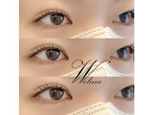 ウェリナ(welina)/
