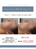 《サマーレスキュー》Deep Route＋脂肪分解　小顔【1day】プラン　¥32,000→