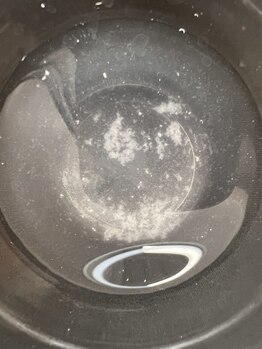 ミュー 多治見店(mieux)/◆毛穴洗浄でとれる汚れ