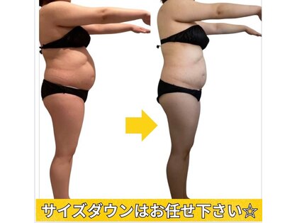 ヨサパーク ユア(YOSAPARK Yua)の写真