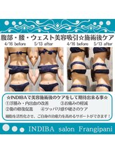 フランジパニ/【インディバ☆美容吸引後ケア】