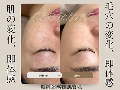 ヒュウ(hue.)の写真