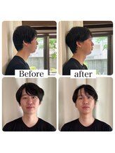 エリシオン(ELYSION)/毛穴たるみ改善