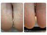 【フットバス付】足裏角質ケア