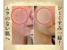 サンテボーテ(Sante Beaute)の雰囲気（サロンケア＆シャルムボースキンケア　Wで40代からのエイジング）