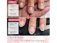 ルリ(Ruri)の雰囲気（爪が傷んでいても当店は爪の回復をさせながらネイルを楽しめます）