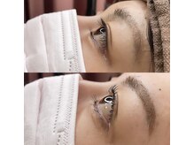 レジアント(Rediant)/パリジェンヌラッシュリフト