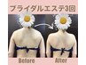 人気【ブライダルオ-ダ-メイド痩身/上半身60分×3回】ハイパ-&肩甲骨脂肪分解