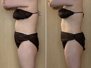 マイティー整骨院 ココア(CoCoa)/活性リンパ洗浄