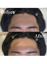 モテテ(motete)/お客様施術例☆栄本店