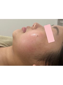 お肌をきれいにしたい