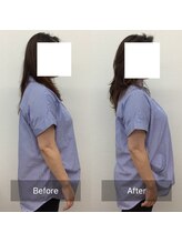 ハリナチュレ 西心斎橋店(HARINATURE)/Before After