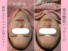 エンクリニカルラボ 京都駅前店(E&N CLINICAL LABO)/韓国クリニックピーリング