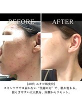ヨサパーク ハグ 北野(YOSA PARK hug)/before × after